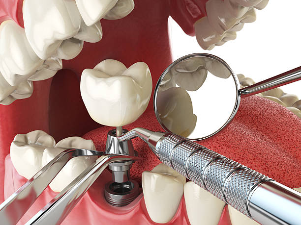 Best Emergency Orthodontic Repairs in Mexico, MO